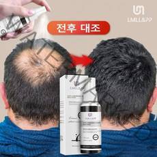 탈모 개선 효과의 탈모 영양제 두피 에센스 발모제, 1개, 100ml